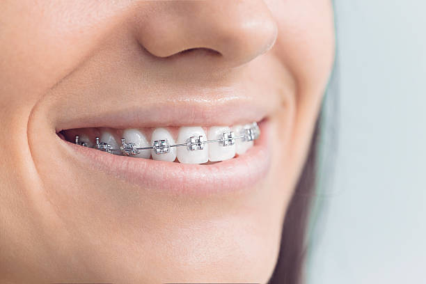 Best Cosmetic Dentistry  in Montpelier, IN